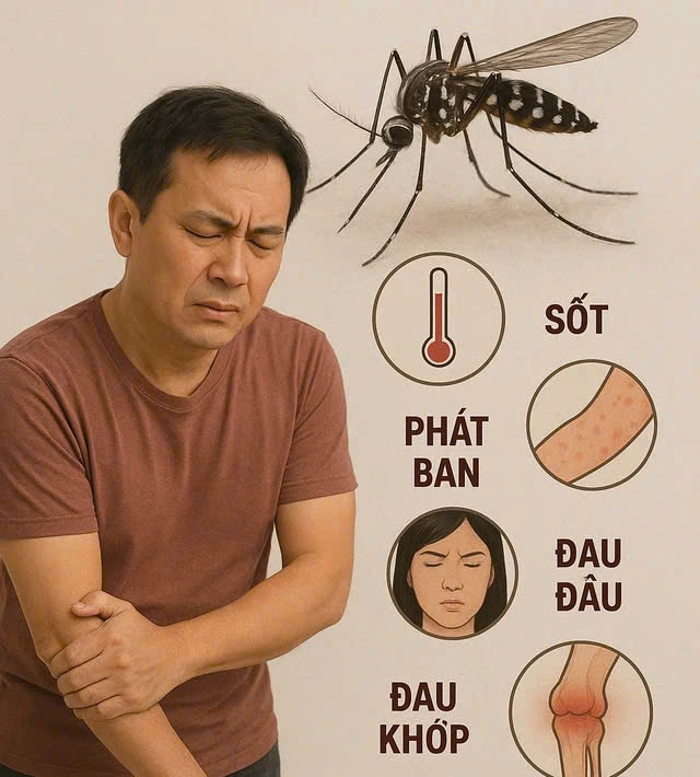 Virus chikungunya gây bệnh 'người đi khom lưng'- Ảnh 1.